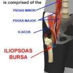 Roche Injury Clinic post on the Iliopsoas Muscle